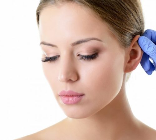 אוזניים - ניתוח אוזניים - ד"ר שמואל לוי - myclinic תל אביב