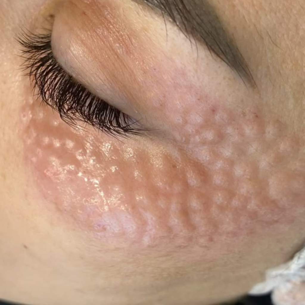 Salmon DNA - Polynucleotides - myclinic Tel Aviv